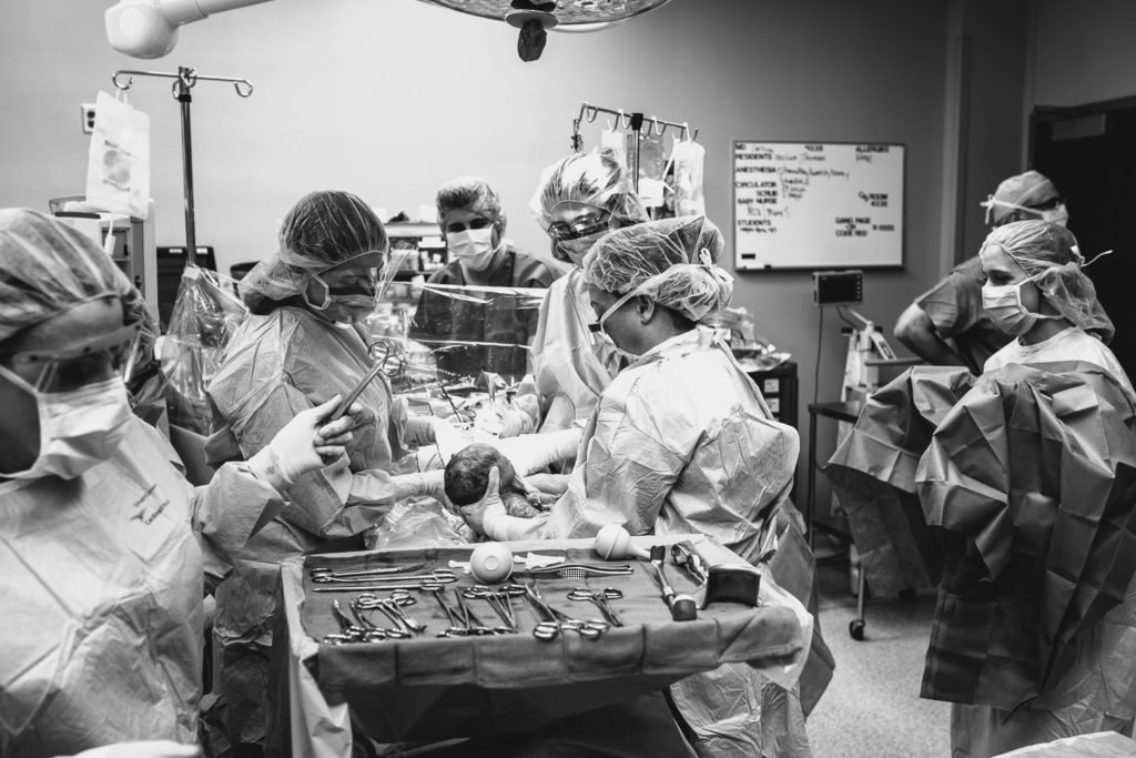 c-section photography