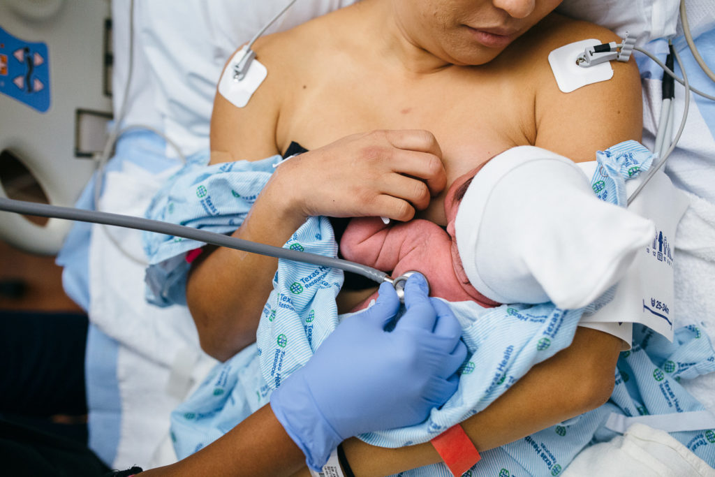 breastfeeding after c-section